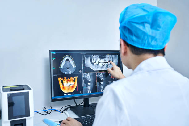Best Emergency Treatment for Dental Infections or Abscesses in Ansonia, CT